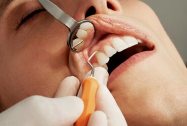 Periodontics